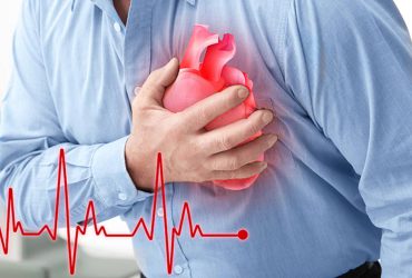 Heart arrhythmia - دکتر منیژه فلاح