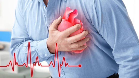 Heart arrhythmia - دکتر منیژه فلاح